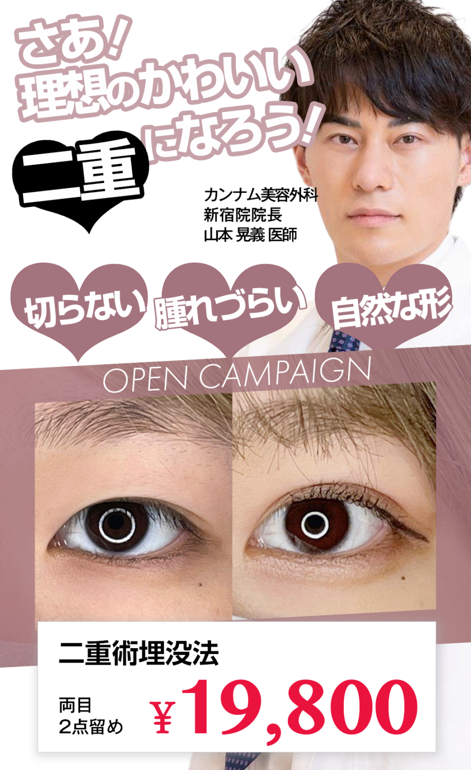 二重整形おすすめクリニック16選！医院の選び方も医師が解説【2024年9月最新版】