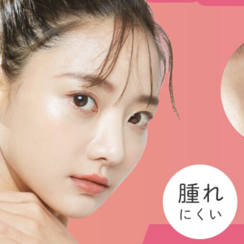 ルラ美容クリニックの埋没法