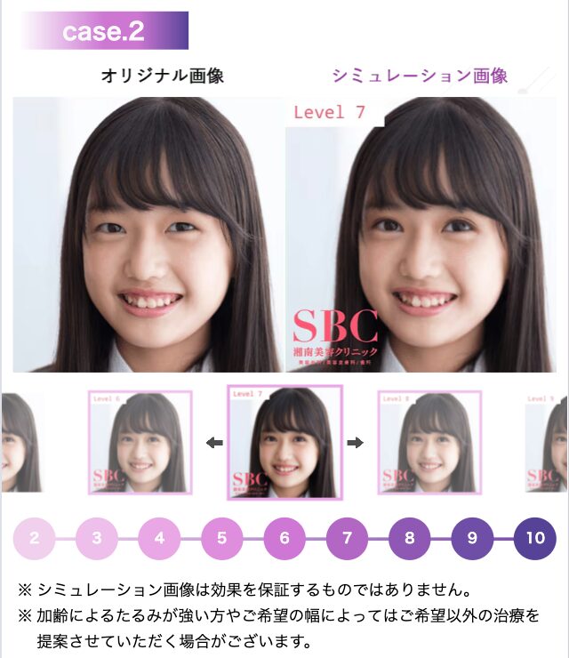SBC AIのシミュレーションイメージ
