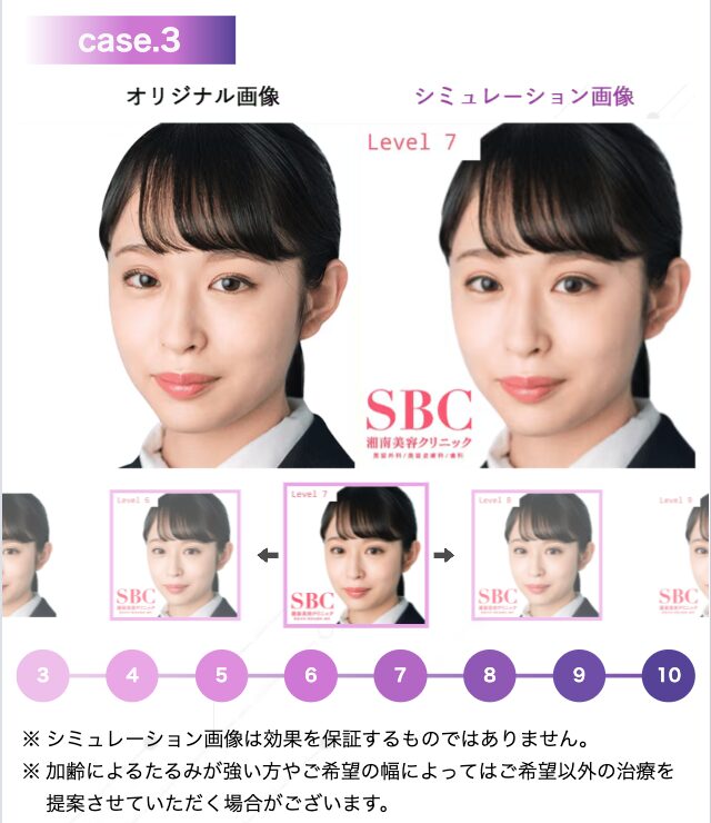 SBC AIのシミュレーションイメージ