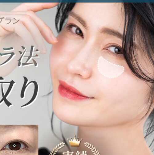 ジョウクリニック クマ取りのイメージ