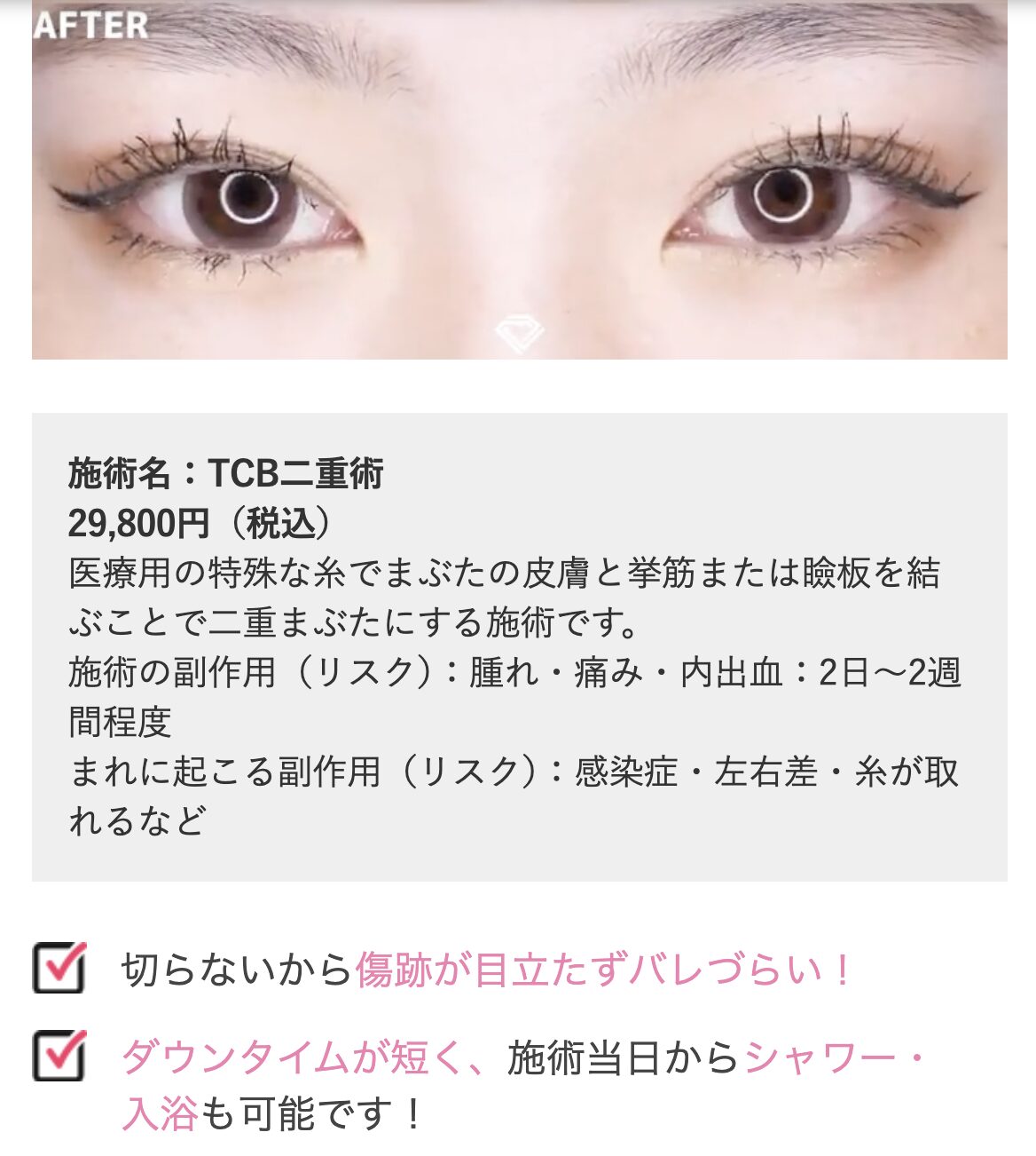 TCBの二重術はダウンタイムが短めで、当日からメイクやシャワーも可能